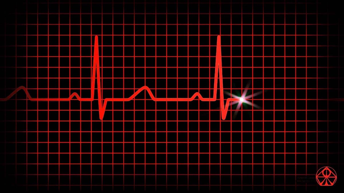 Кардиограмма картинка прикольная