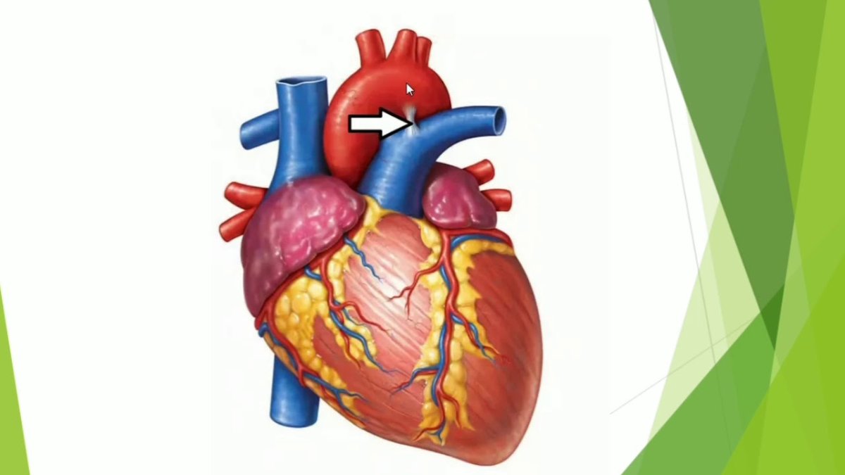 Человеческое сердце анатомия