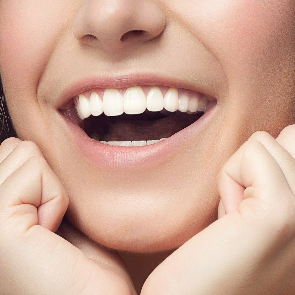 фото красивых женских зубов