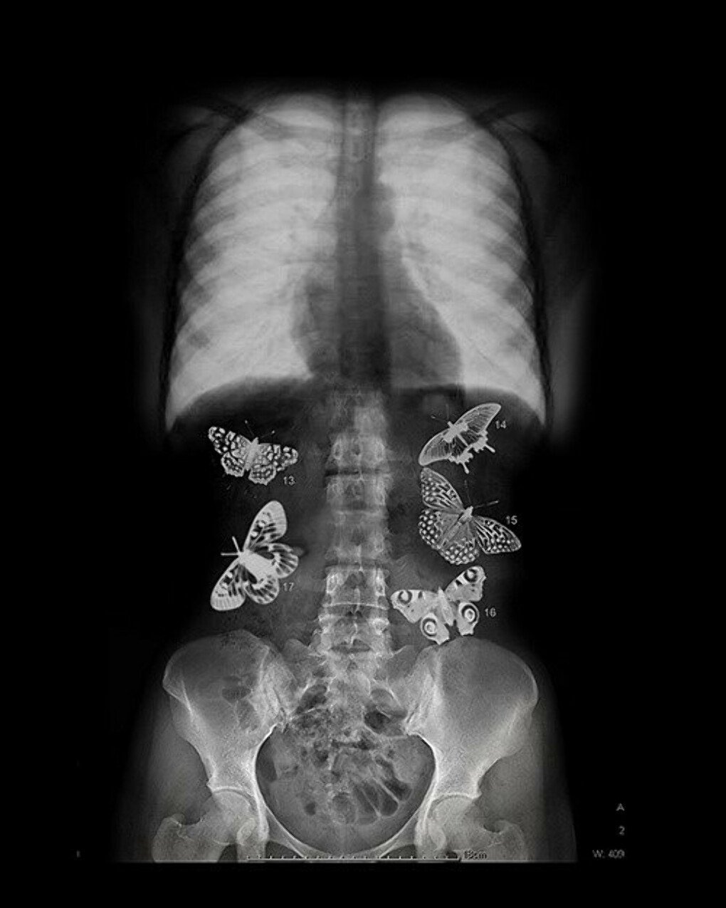 Ревген бабочки в живате